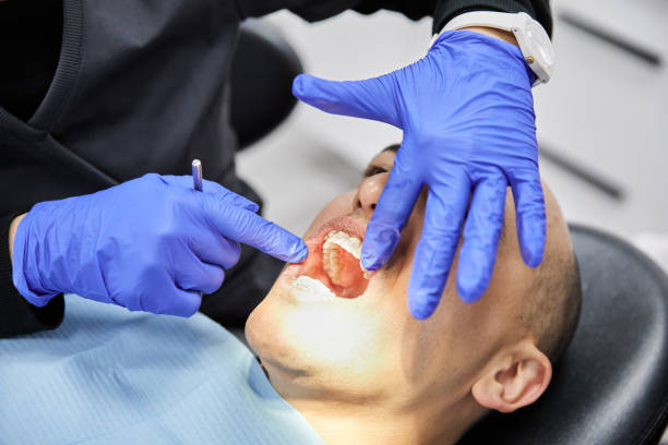 Best Emergency Tooth Extraction in Utica, NE